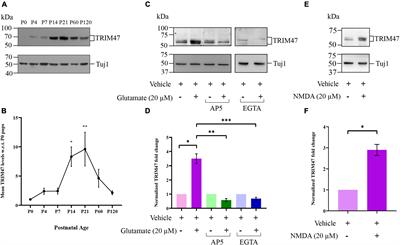 Activity-regulated E3 ubiquitin ligase TRIM47 modulates excitatory synapse development